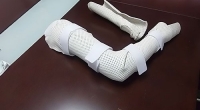宜春南昌矯形器-步行矯型器在脊髓損傷中的作用