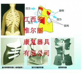 新余南昌脊柱矯形器