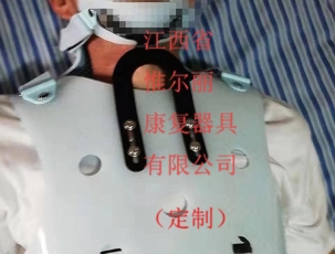 案例展示