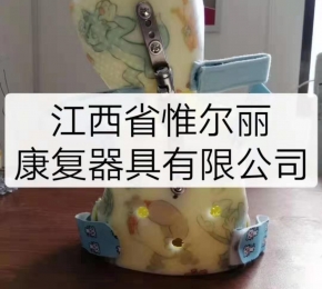 撫州兒童軀干矯形器